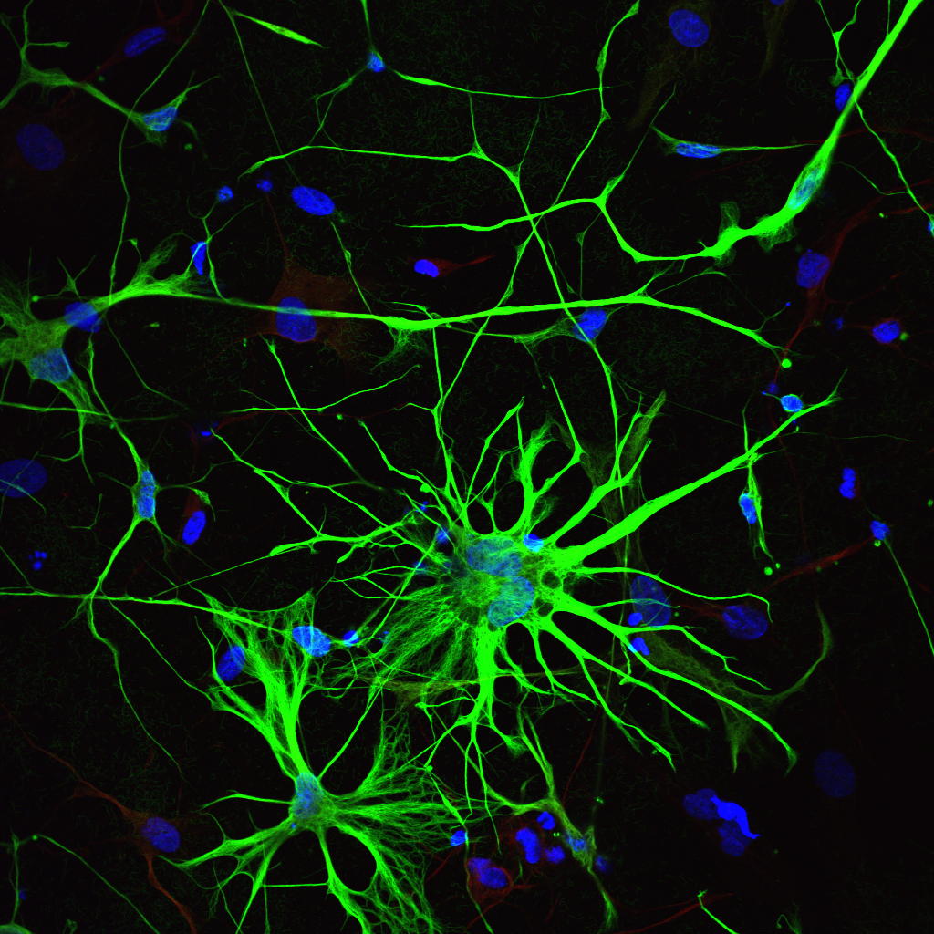 Астроциты мозга. Astrocyte. Астроциты клетки. Микроглия и Нейроны. Глиальные клетки.