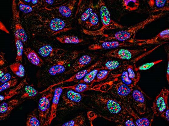 The ChipCytometry platform operates by immobilising cells in microfluidic chips