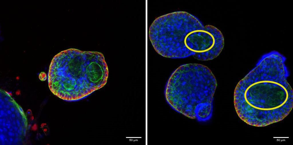 amsbiopr279-imageB