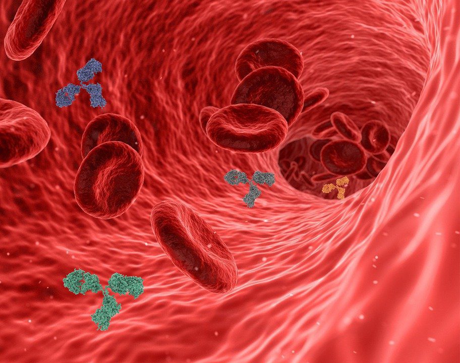 EPO image 29