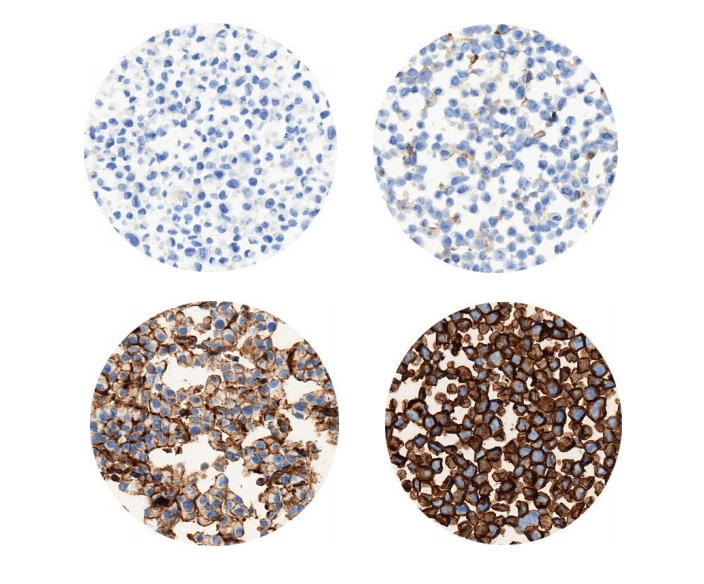 amsbiopr286-imageB