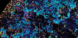AI tools can be used to define spatial context of cellular phenotypes within the tumour microenvironment