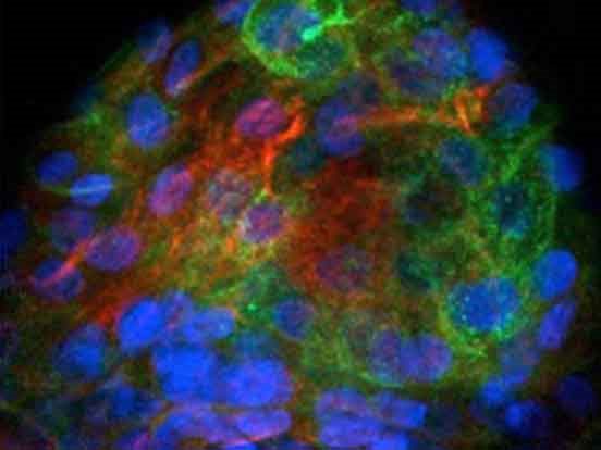 amsbiopr298-imageB