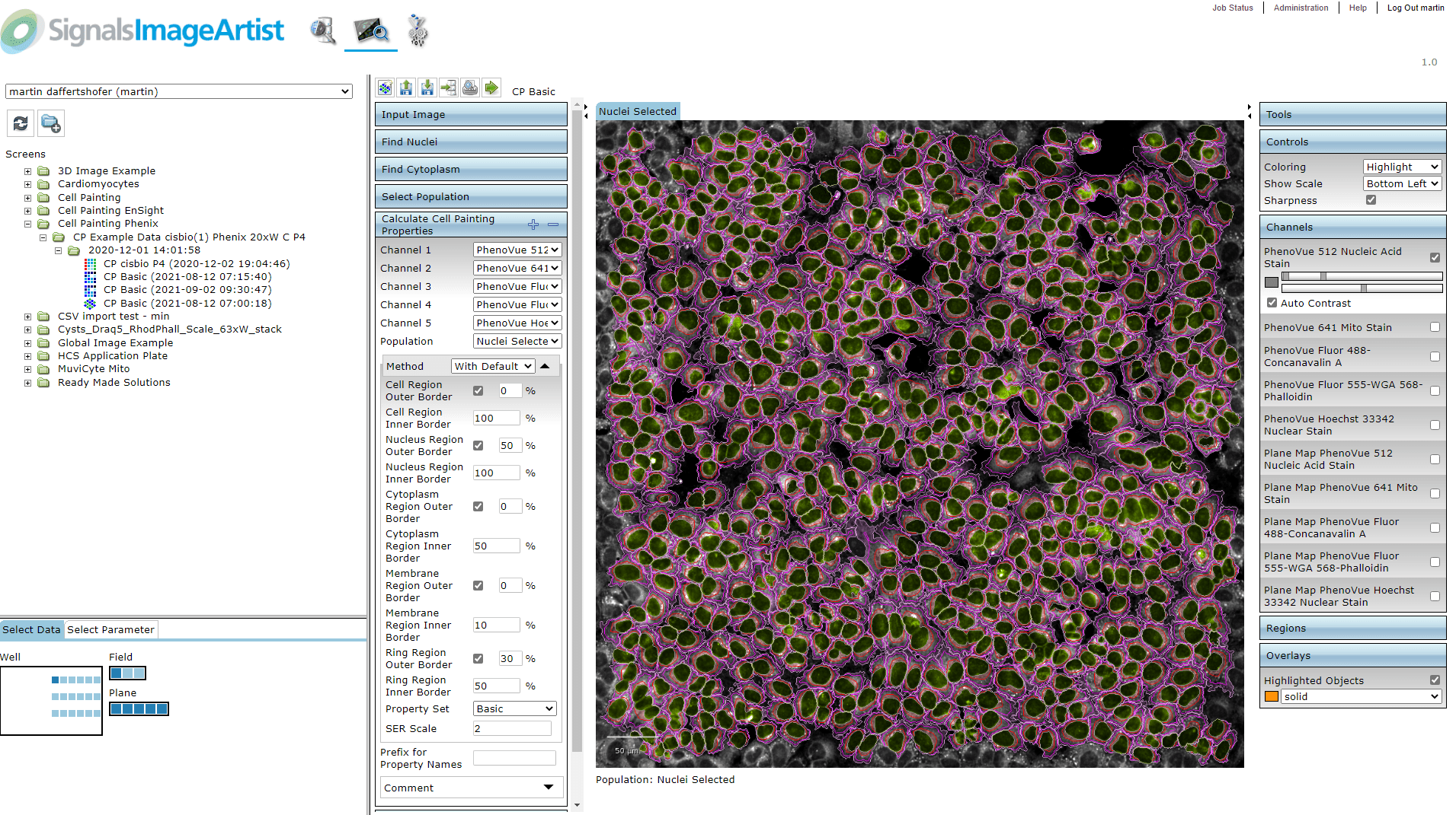 Signals Image Artist PerkinElmer Cell Painting Analysis