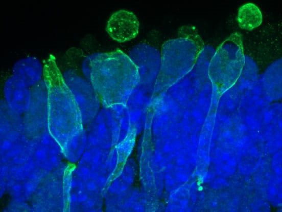 amsbiopr302-imageB