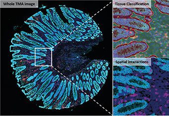 Fig. 2. Comprehensive phenotypical analysis including single cell detection, tissue classification and assessment of spatial relationships