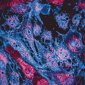 The flexibility of compact, mobile, photoacoustic imaging equipment is helping to advance groundbreaking medical diagnostics