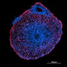 Cortical organoid captured using Cicero