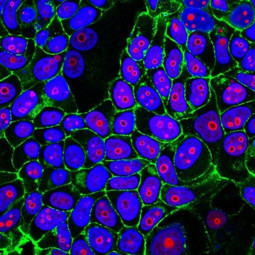 CF555-Cyclin-B1-CF488A-phalloidin-MCF7-IF