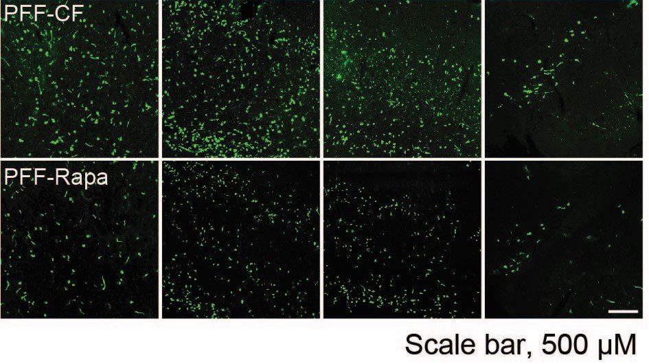 Newsroom Vanessa Dec 18 alpha-synuclein protein (1)
