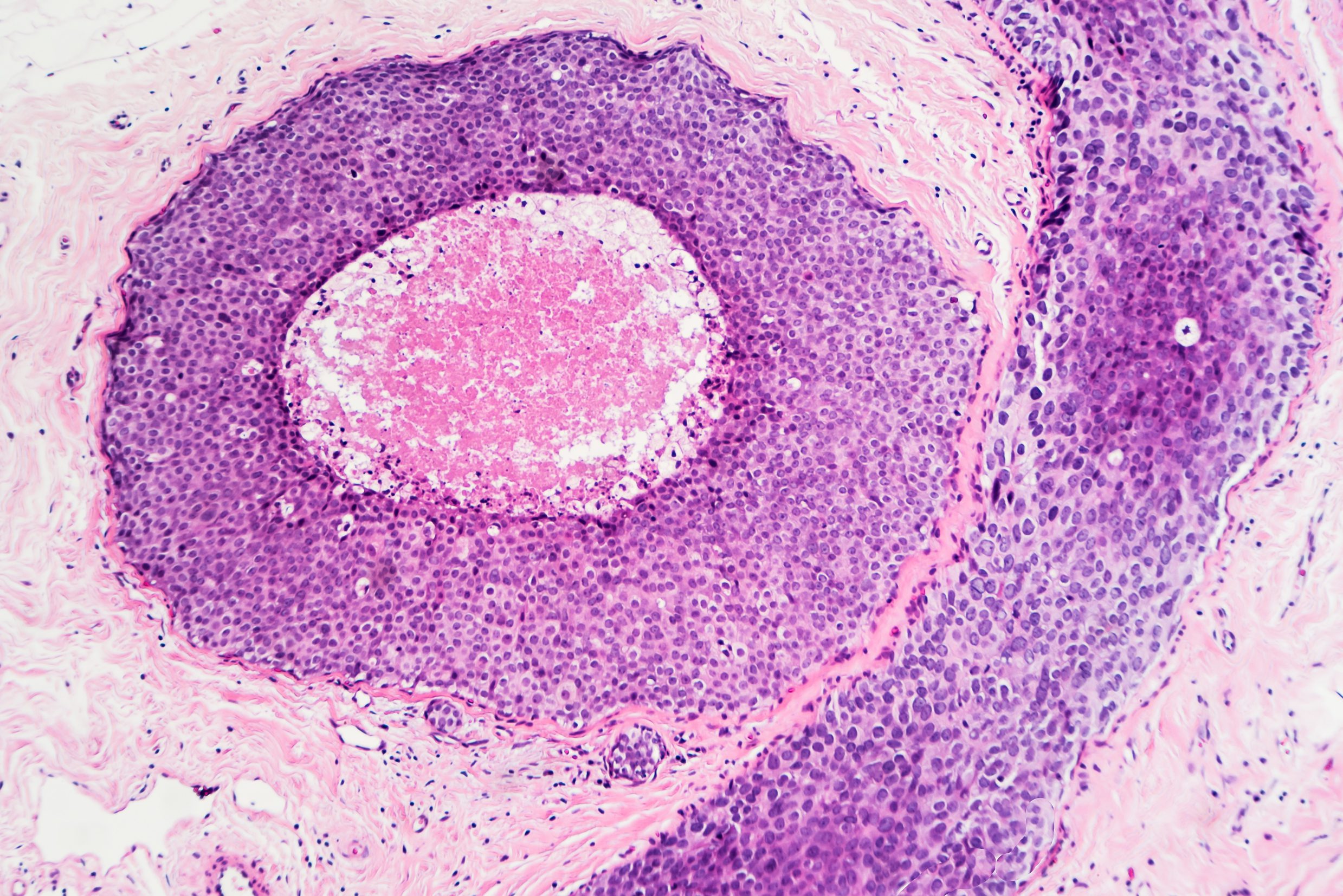 amsbiopr375-image