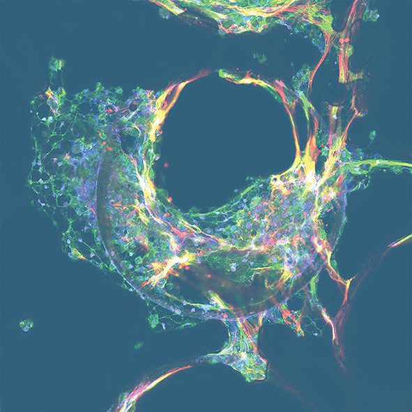 LIVER Eurolab