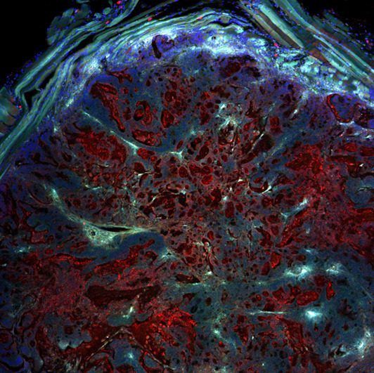 amsbiopr379-imageB