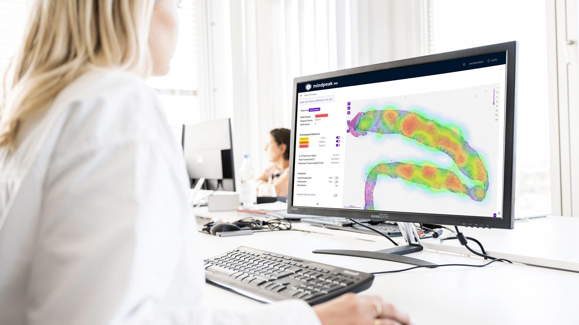 zeiss-to-invest-in-mindpeak-to-accelerate-ai-based-digital-pathology_prev
