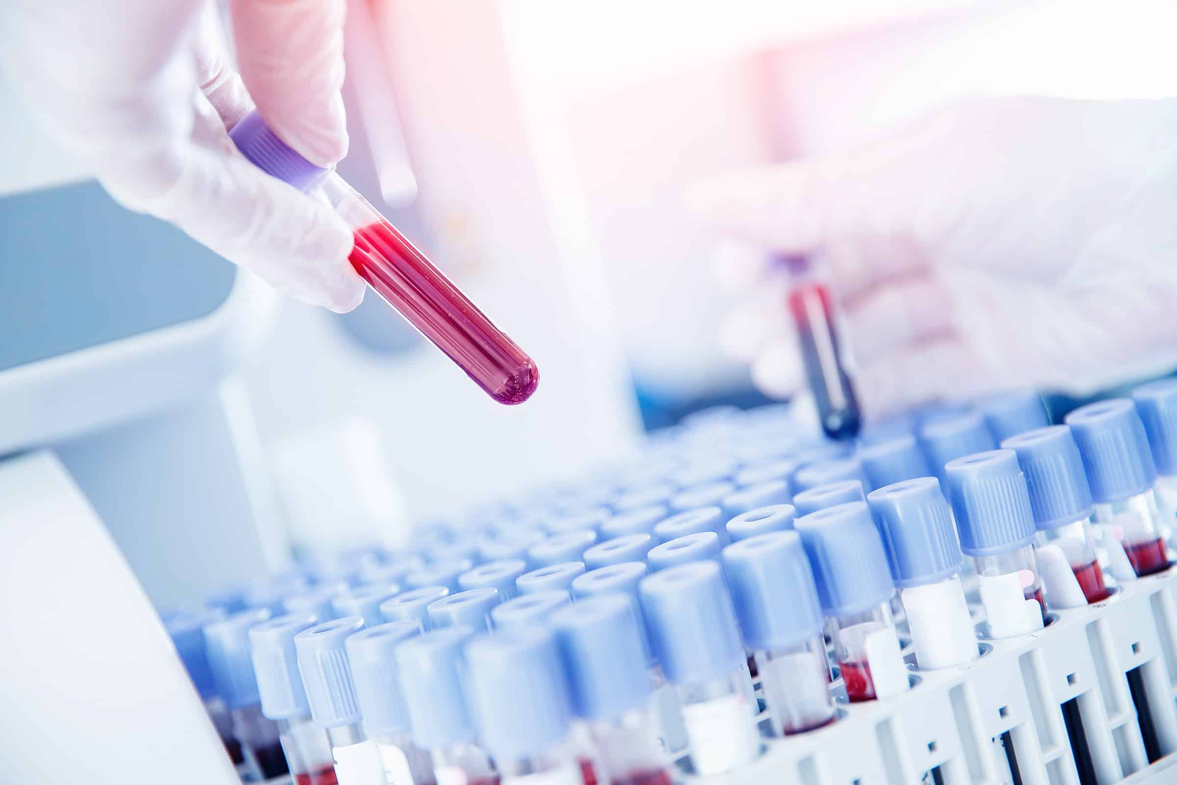 blood-testing