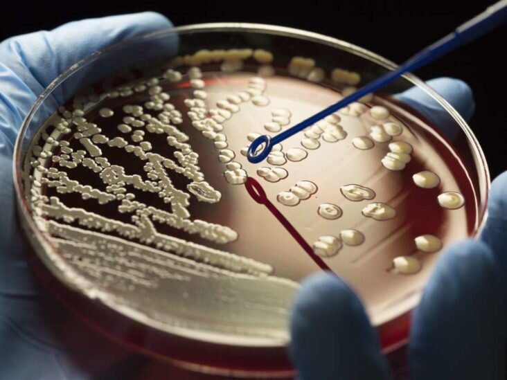 bacteria