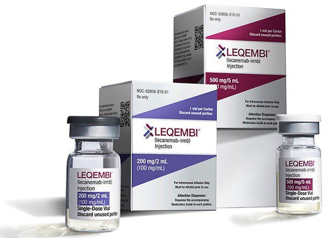 Alzheimers article pic