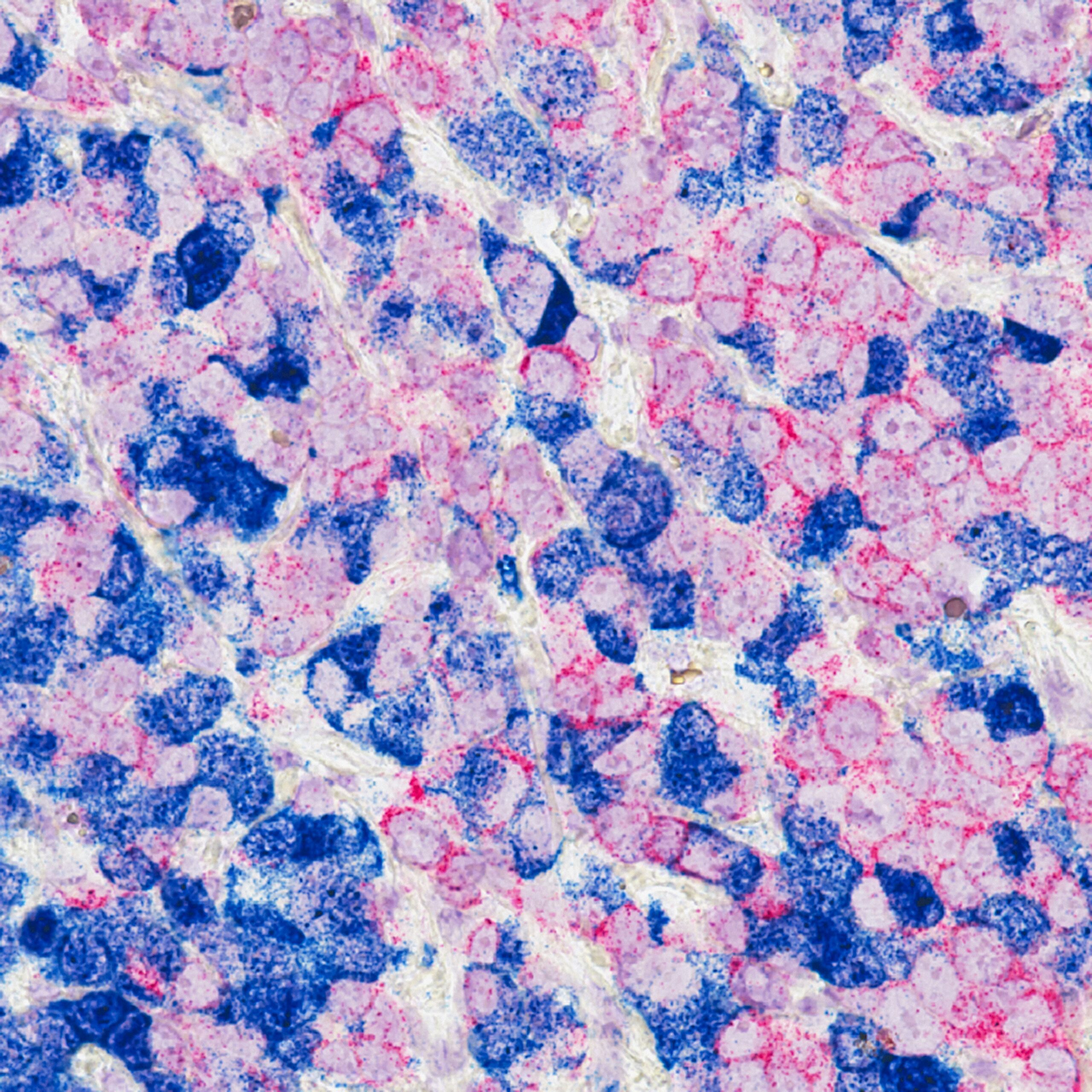 Cancer cells, image via National Cancer Institute on Unsplash